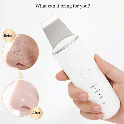 Ultrasonic Facial Cleansing & Skin Scrubber